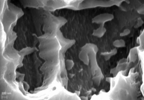 Abbildung: Oberfläche Titanimplantat 50000x Vergrößerung